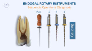 secuencia operatoria de endodoncia