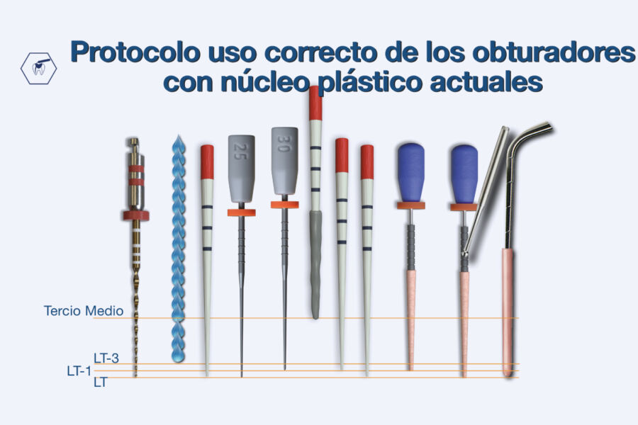 protocolo-obturacion-gaite protocolo-obturacion-gaite